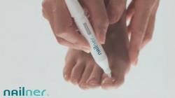 Nailner, el bolígrafo que elimina los hongos de las uñas